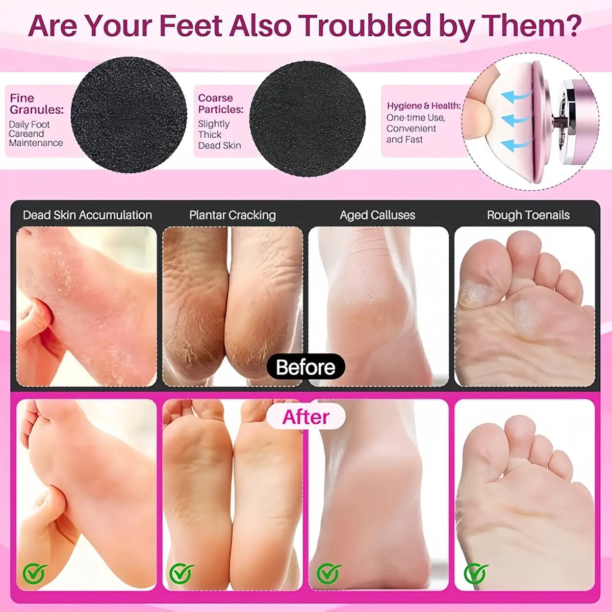 Flexiverse Recargable Removedor De Callo Lima Para Pies+taladro De Uñas